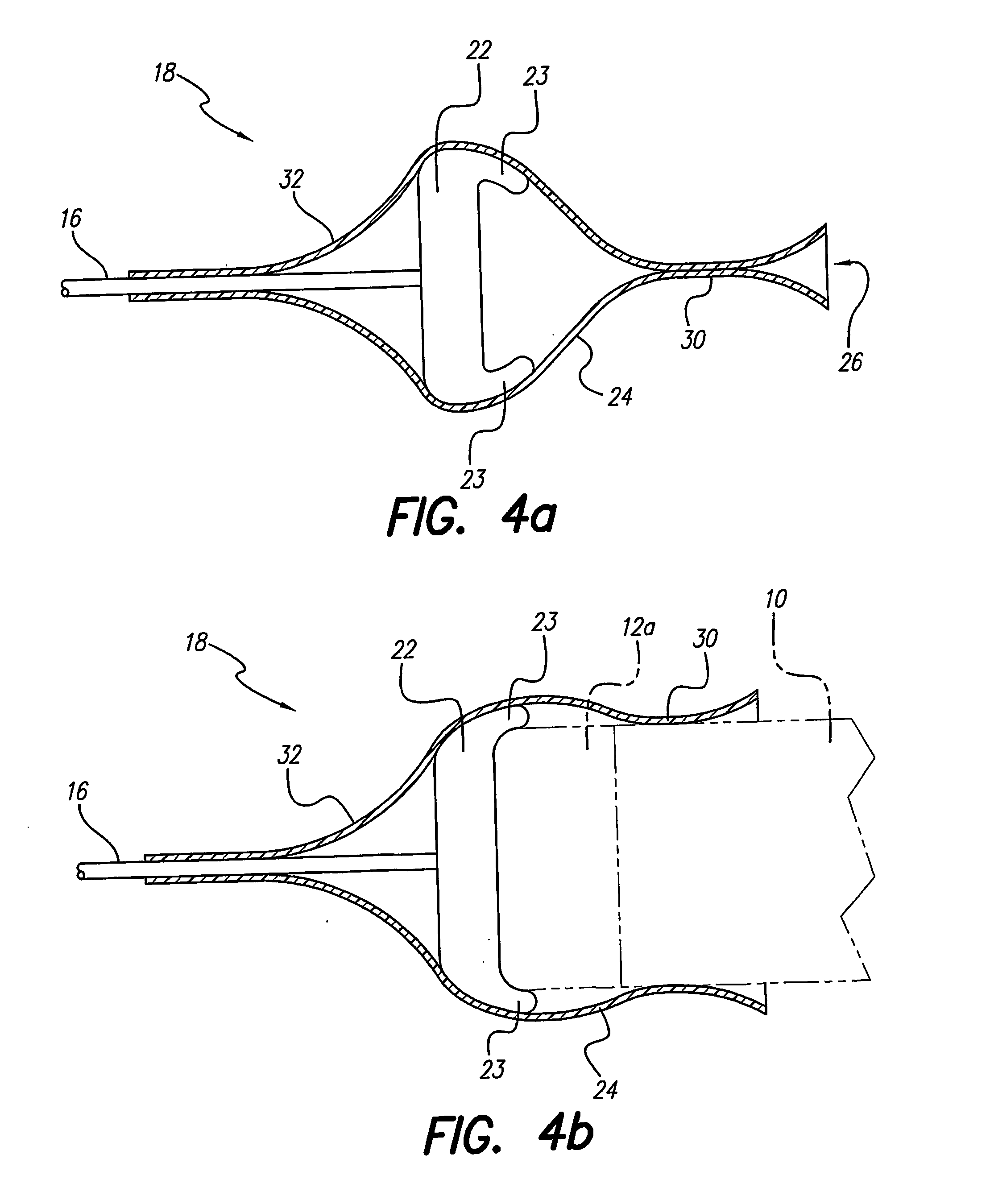 Lead assembly for implantable microstimulator