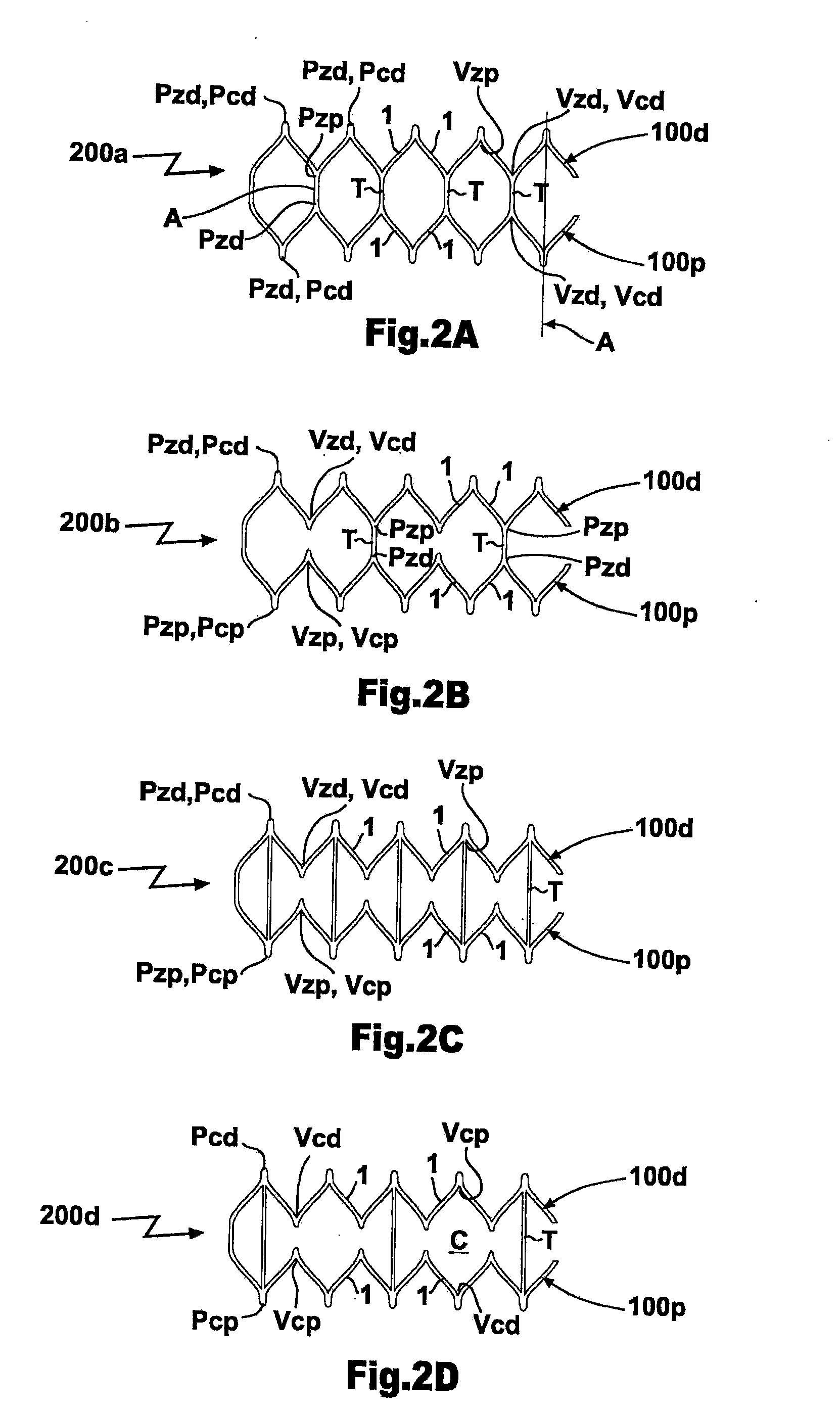 Multi-Segment Modular Stent And Methods For Manufacturing Stents