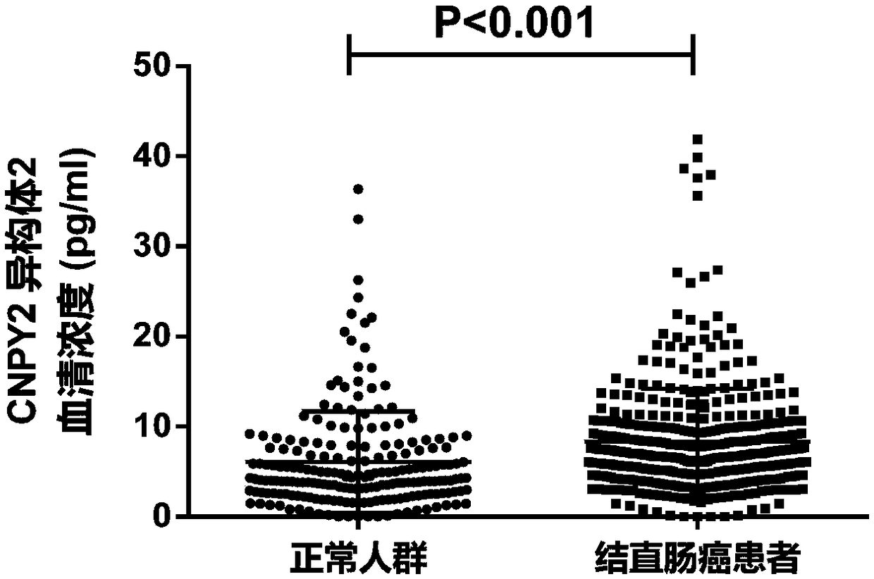 Application of CNPY2 isomer 2 to diagnosis, prognosis, relapse and metastasis as well as radiotherapy and chemotherapy effect prediction of colorectal cancer