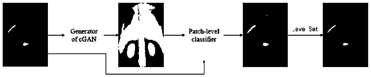 Bone scanning image hotspot segmentation method and system, medium and equipment