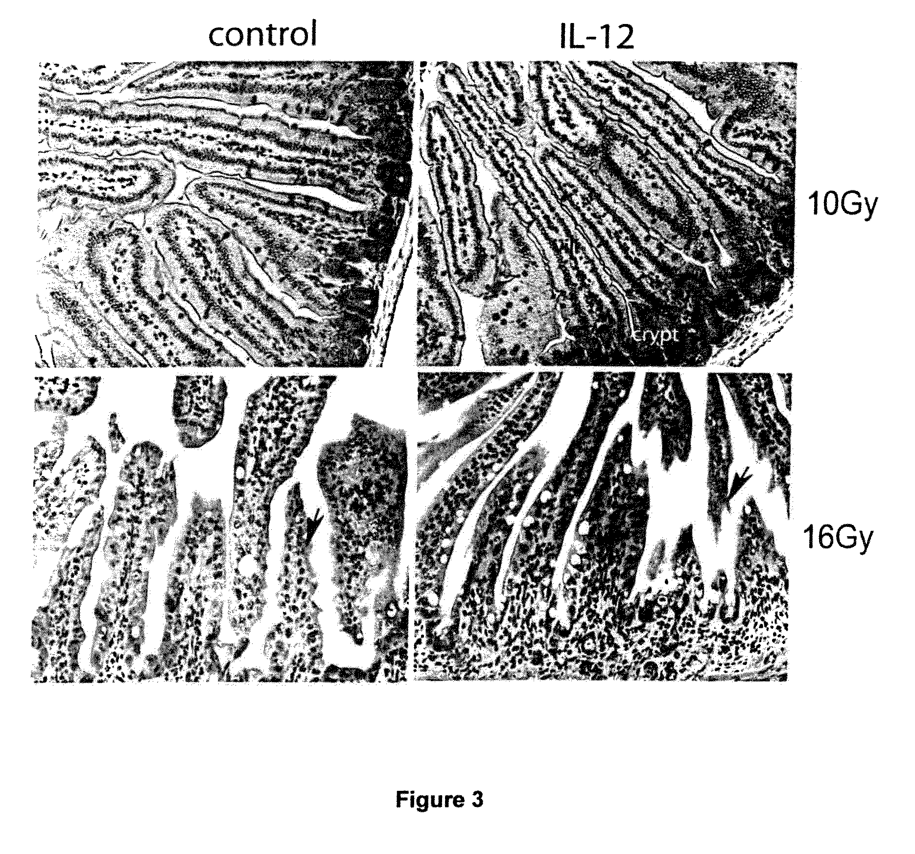 Method for bone marrow preservation or recovery