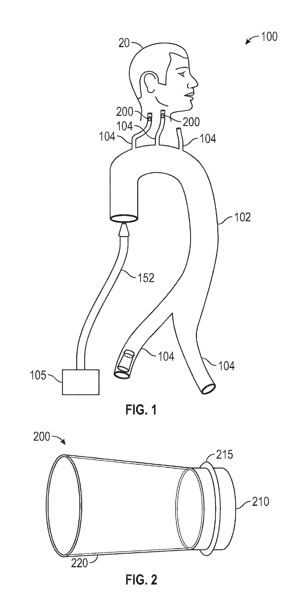 Reconstitution of post mortem circulation, specialized methods and procedures