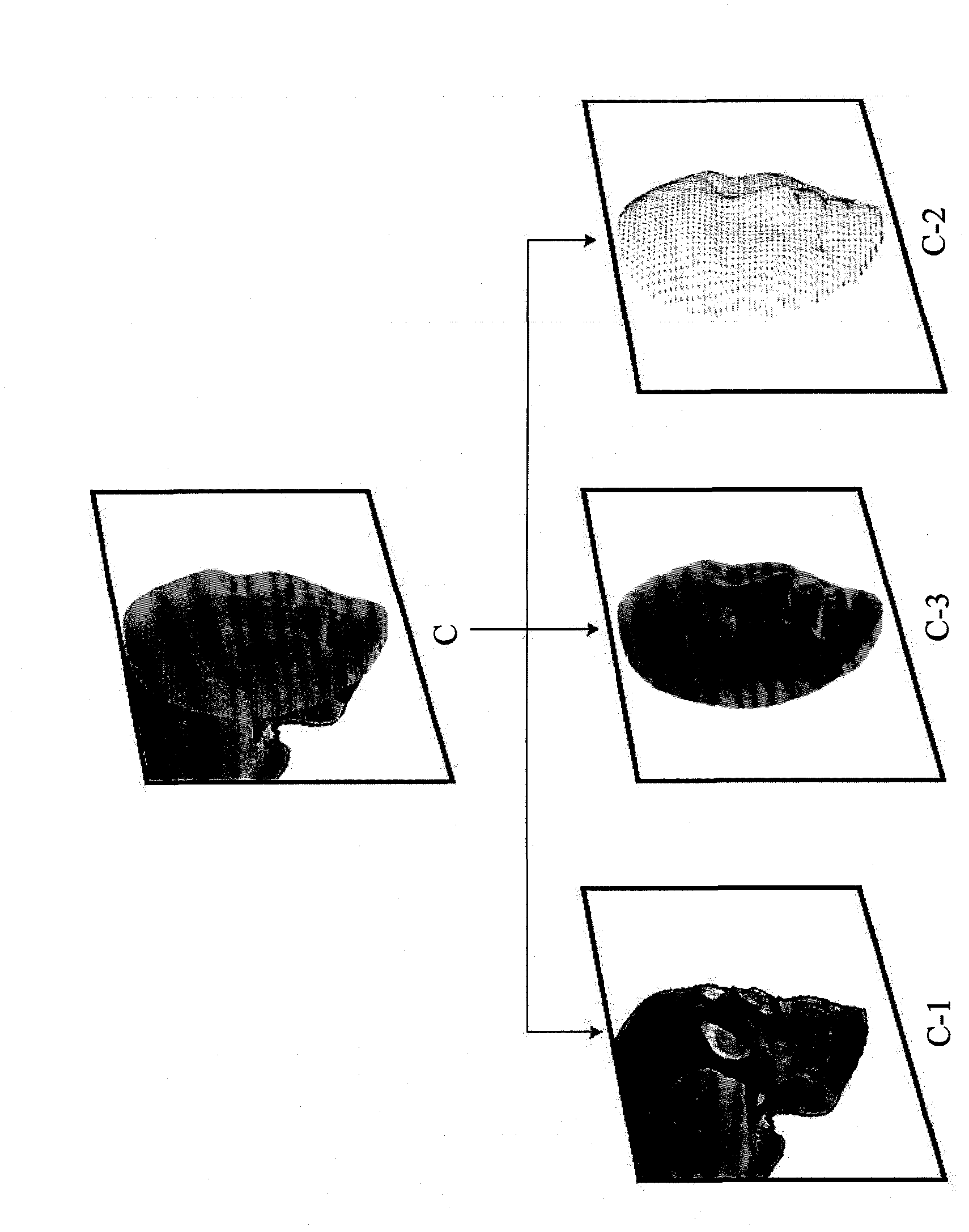 Three-dimensional digital magnifier operation supporting system