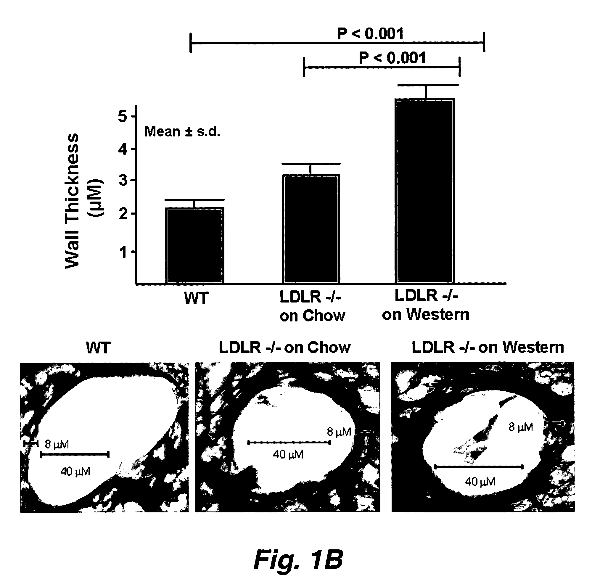 Methods for improving the structure and function of arterioles