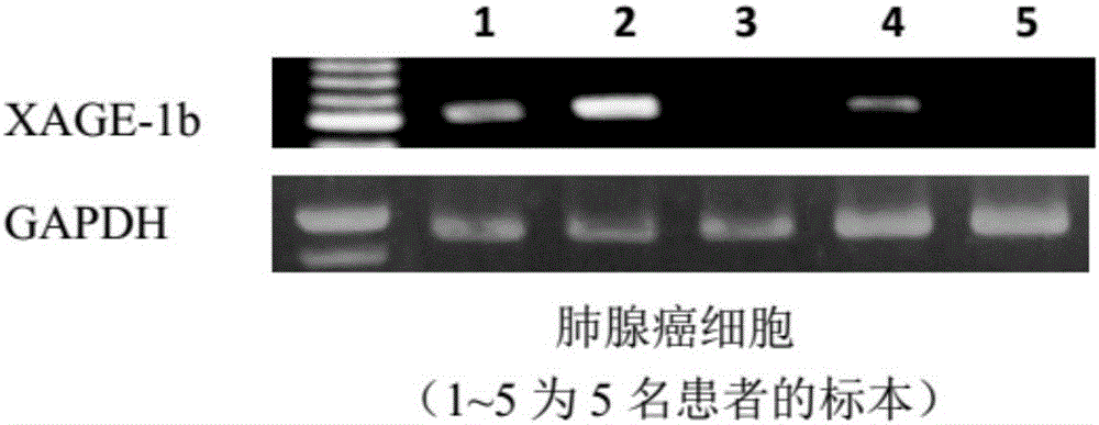 Tumor associated antigen XAGE-1b short peptide and application thereof
