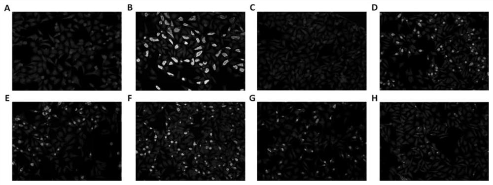 Application of small molecule inhibitors of erk signaling pathway in inhibiting chlamydia infection