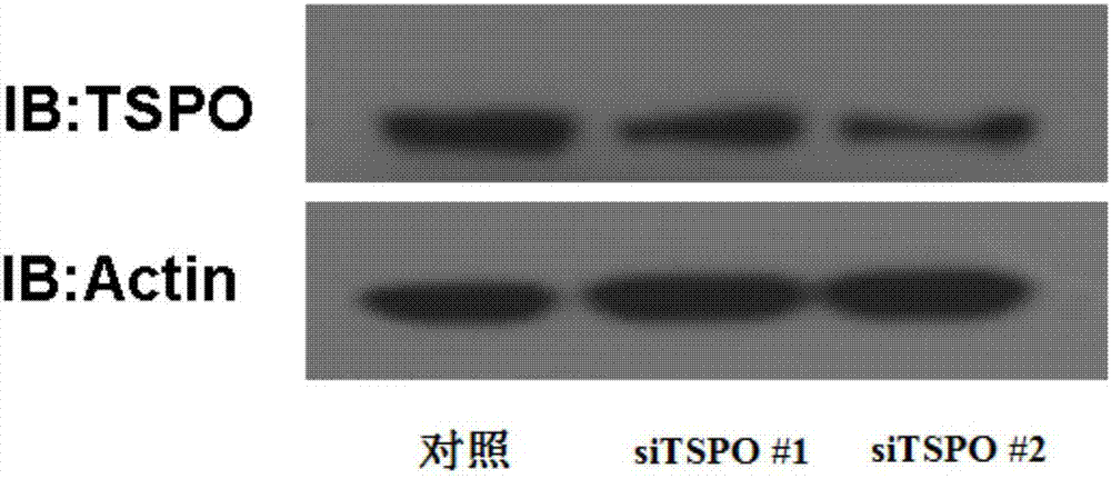 Application of TSPO (Translocator Protein) in treatment of brain glioma and recombinant herpes simplex virus as well as preparation method and application of recombinant herpes simplex virus