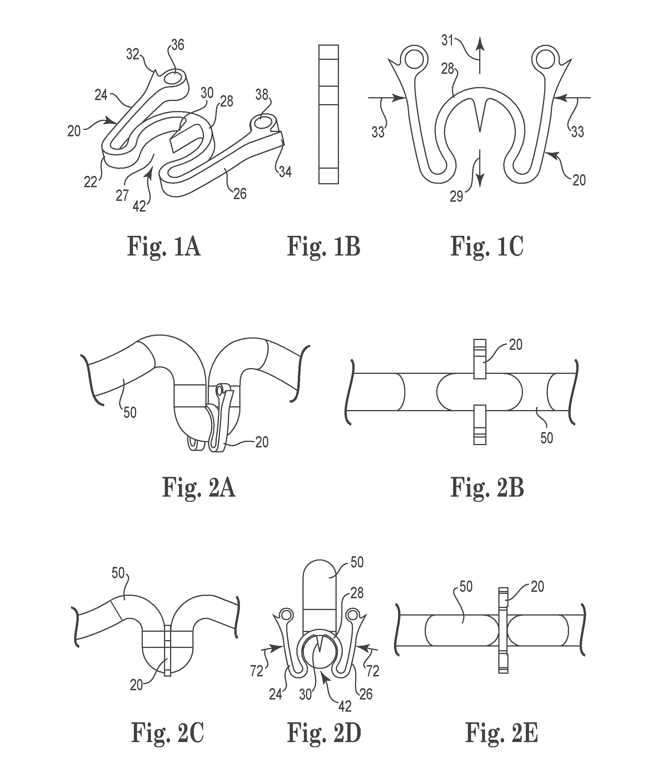 Tissue fixation system with single component anchor