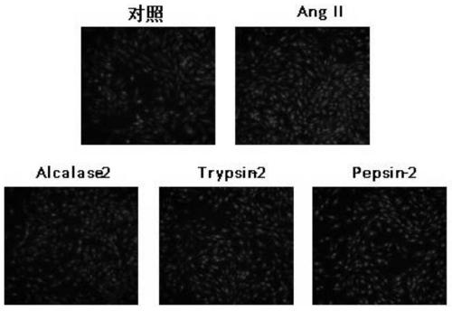 Application of Broad Bean Protein Peptide in Preparation of Drugs for Treating Inflammation and Drugs