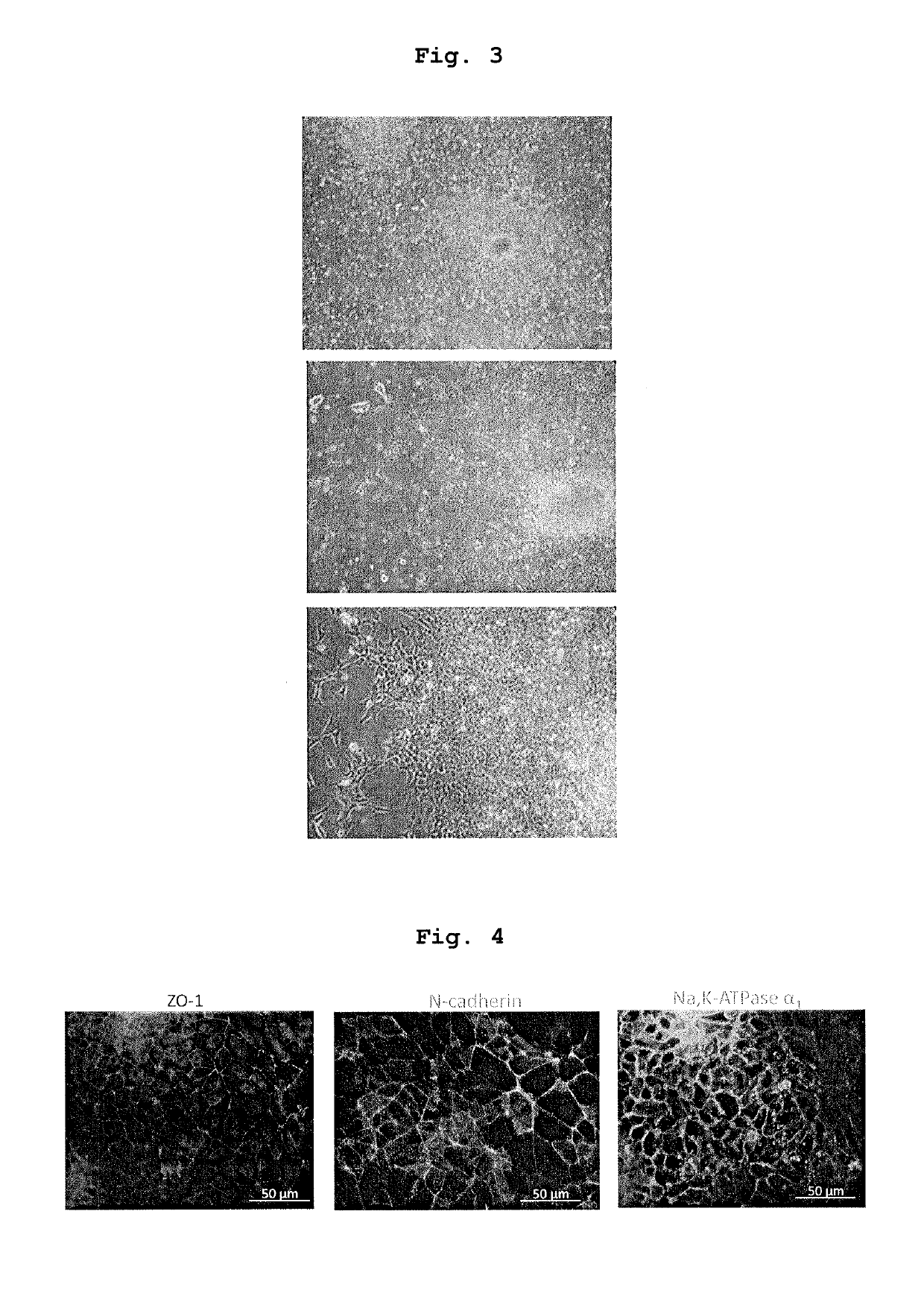 Method for producing therapeutic corneal endothelial substitute cell sphere