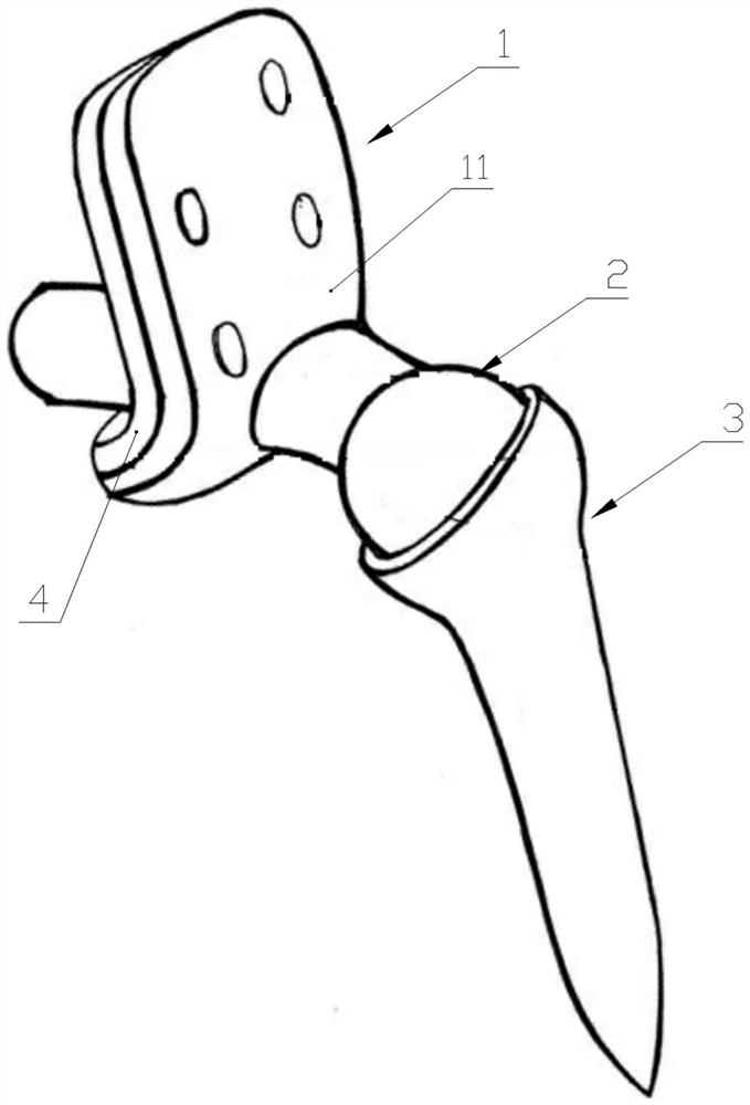 Personalized semi-pelvic prosthesis and making method thereof