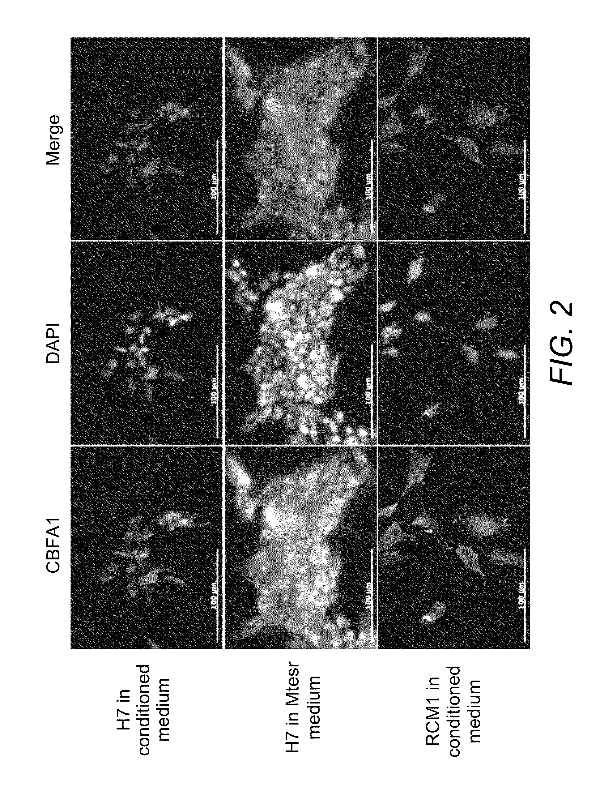 Chondrogenic progenitor cells, protocol for derivation of cells and uses thereof