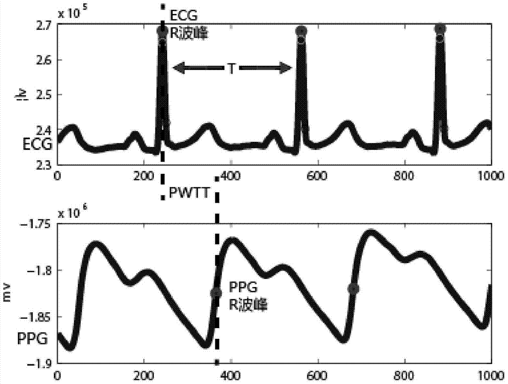 A non-invasive continuous blood pressure measurement method