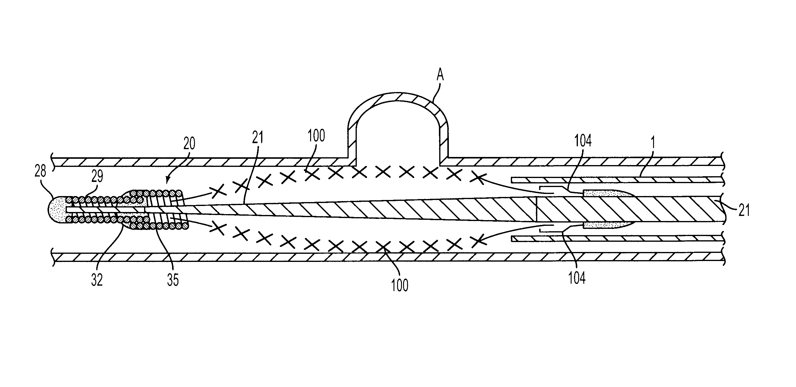 System and method for delivering and deploying an occluding device within a vessel