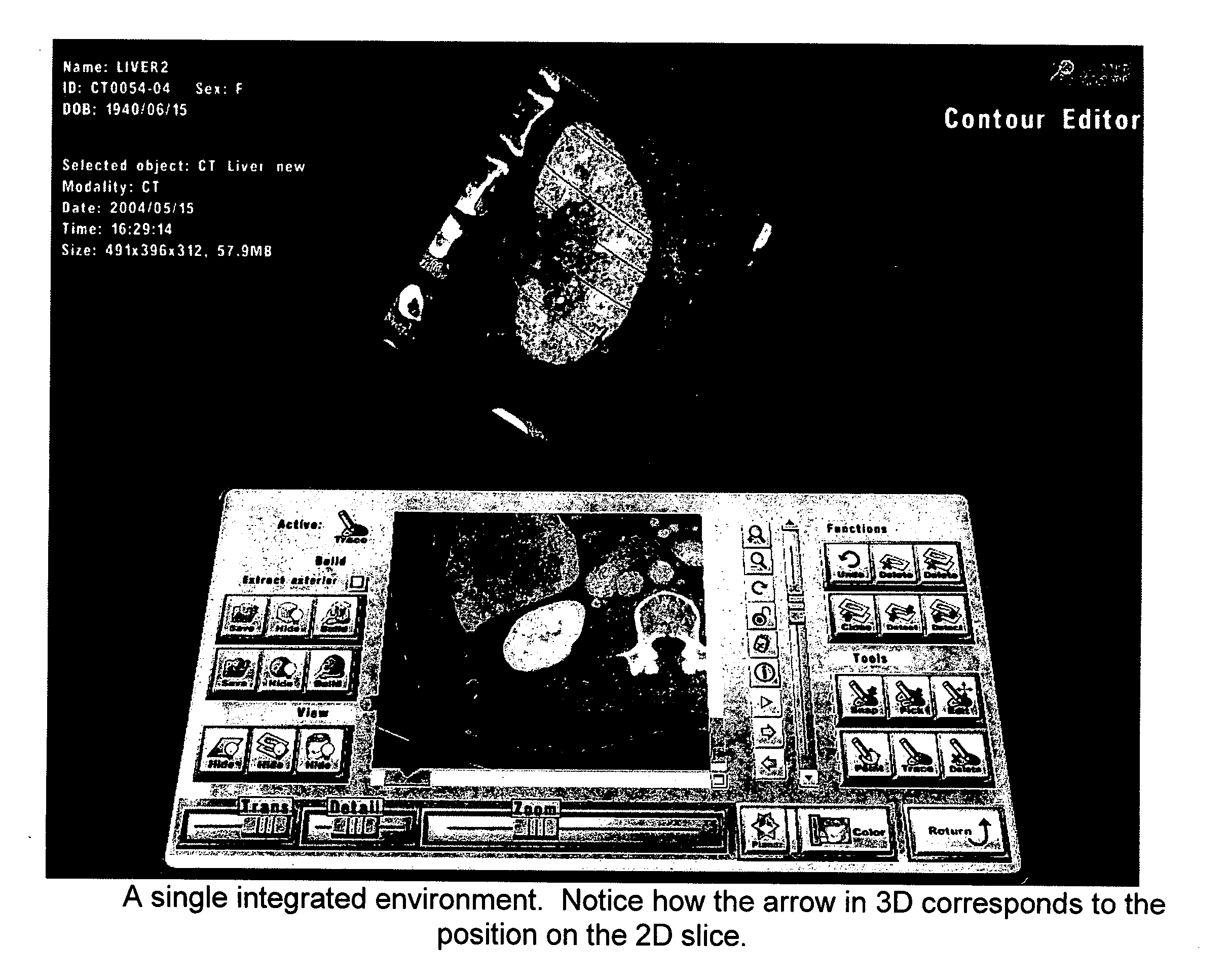 Systems and methods for segmentation of volumetric objects by contour definition using a 2D interface integrated within a 3D virtual environment ("integrated contour editor")