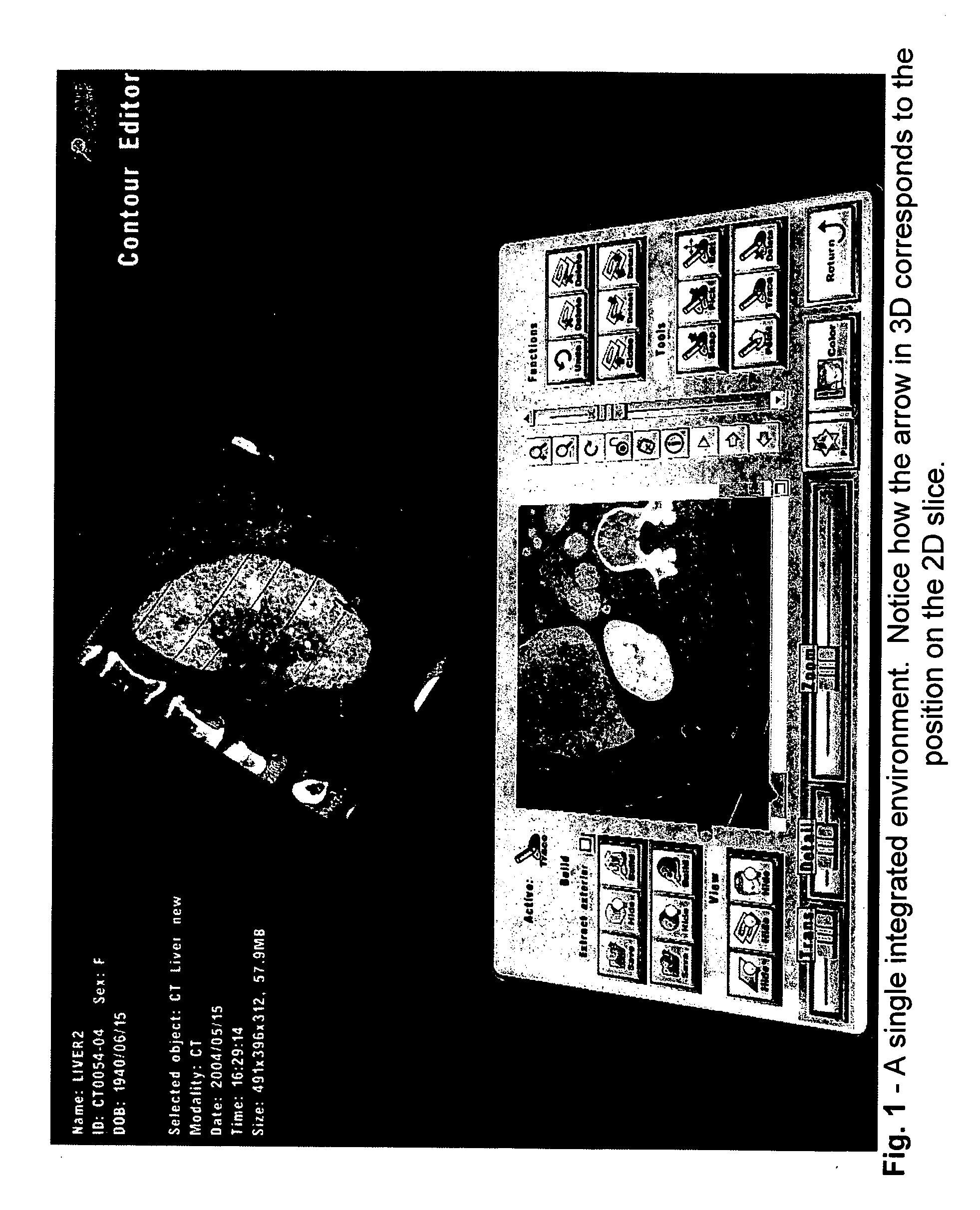 Systems and methods for segmentation of volumetric objects by contour definition using a 2D interface integrated within a 3D virtual environment ("integrated contour editor")