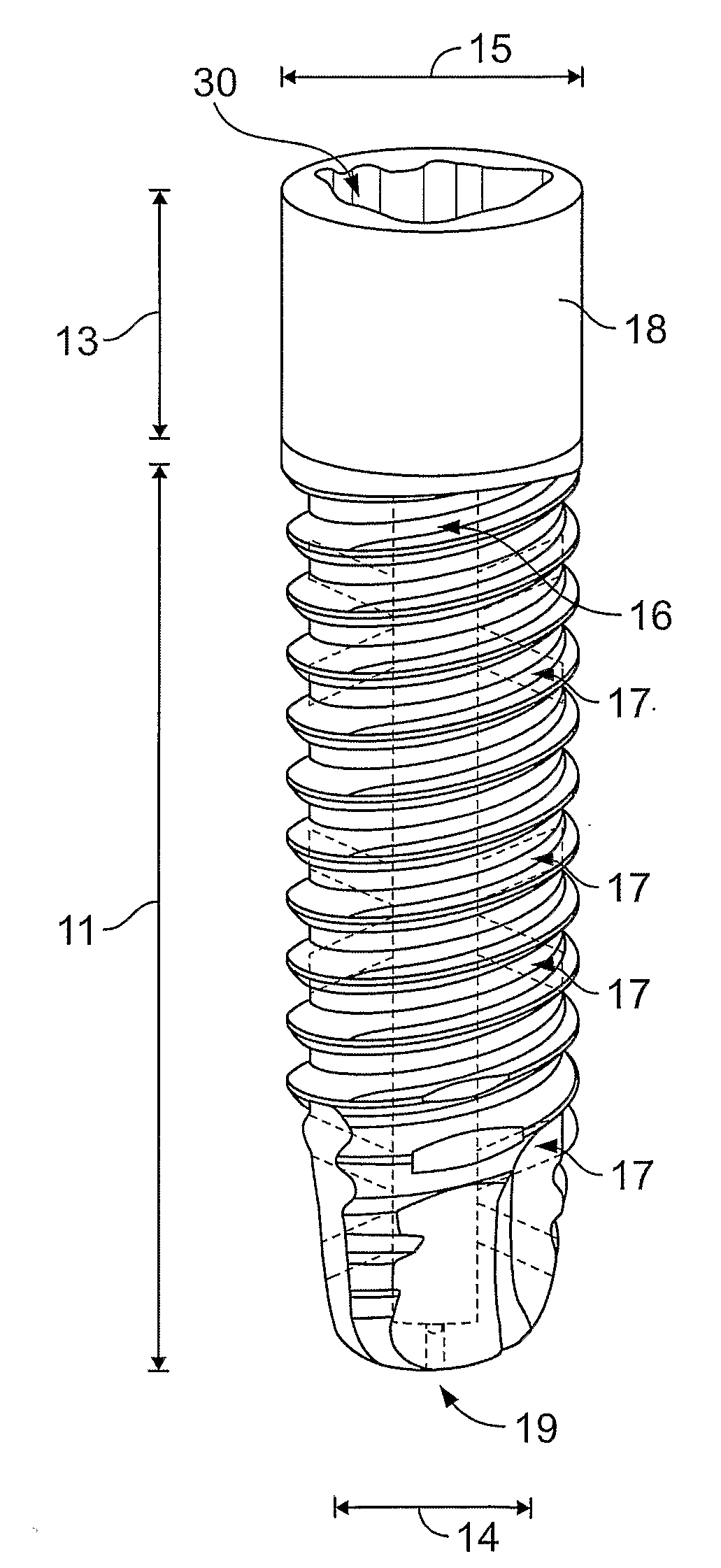 Dental Implant Screw and Method of Use