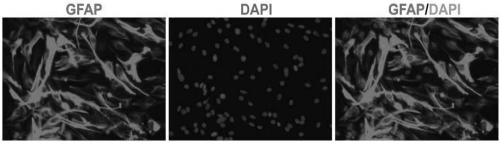 Method for generating functional noradrenaline neurons through reprogramming