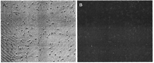 A preparation method, kit and application of human oligodendrocyte progenitor cells that inhibit secondary nerve injury