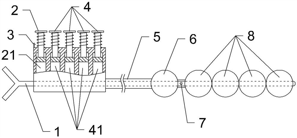 Method for lavaging intestinal tract through intestinal stoma