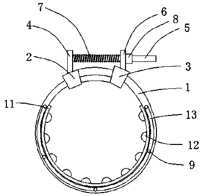 An orthopedic splint fastening device