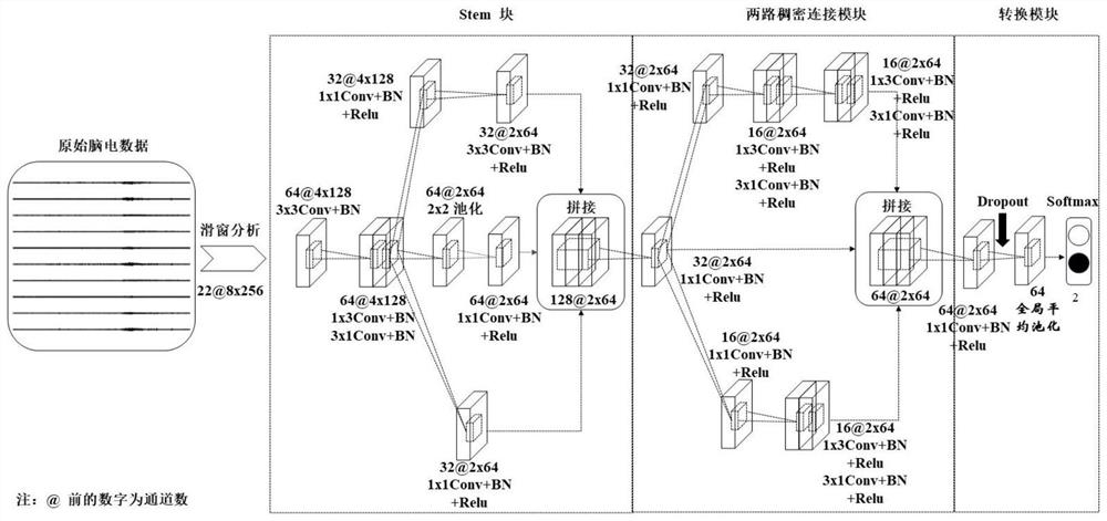 Electroencephalogram signal classification method based on model uncertainty learning