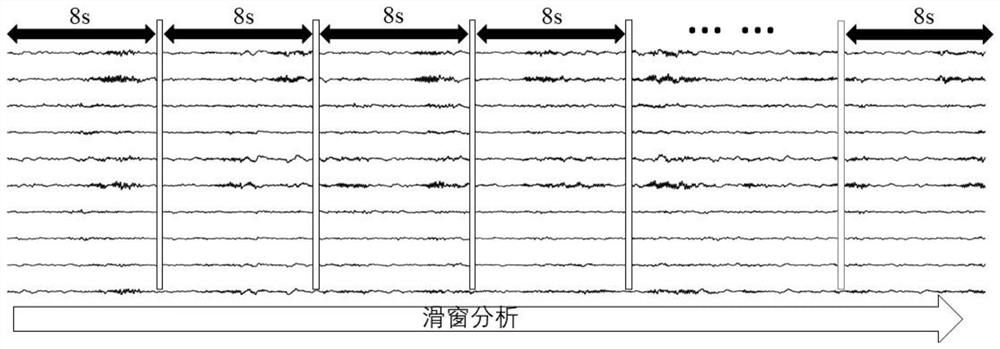 Electroencephalogram signal classification method based on model uncertainty learning