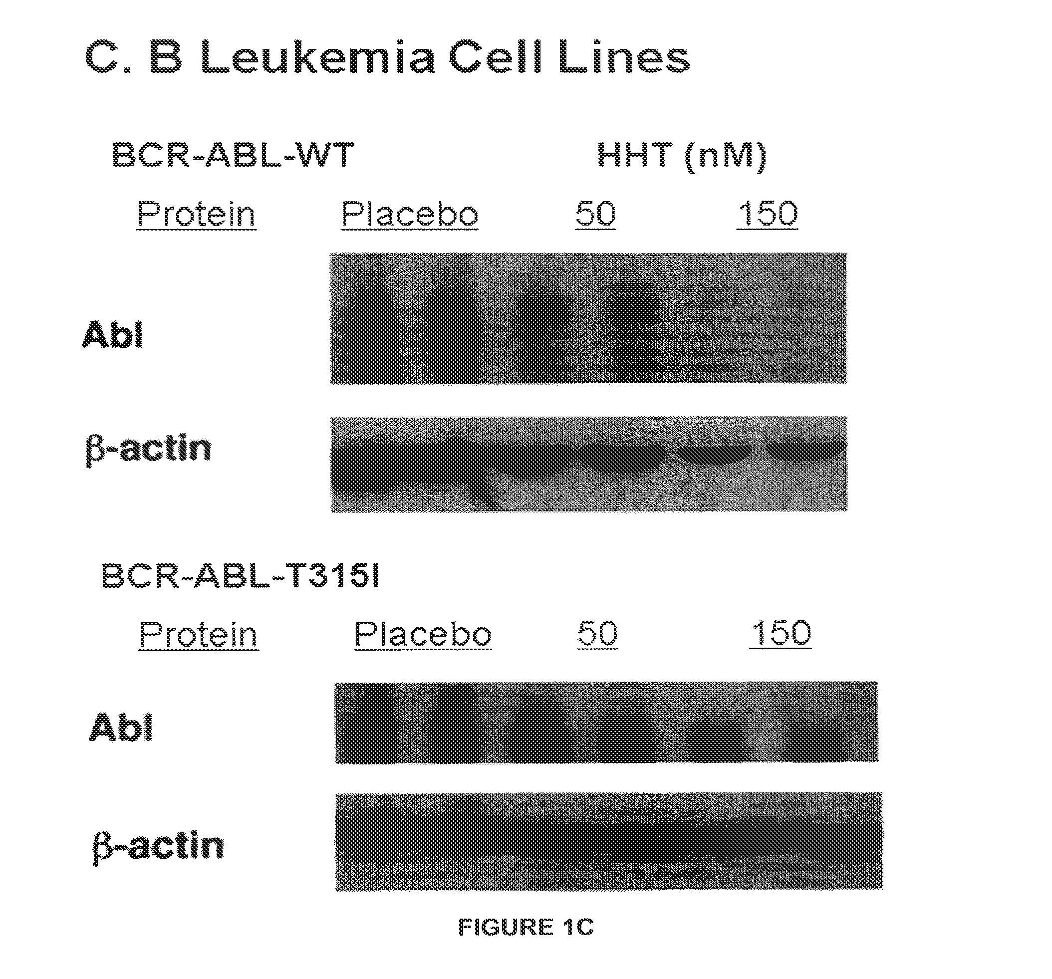 Leukemic Stem Cell Ablation