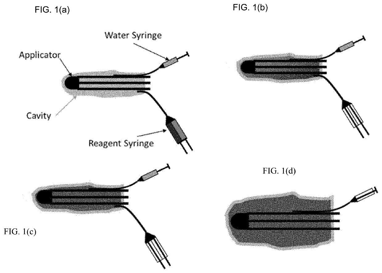 Thiol-michael addition hydrogel-based brachytherapy system and methods comprising the same