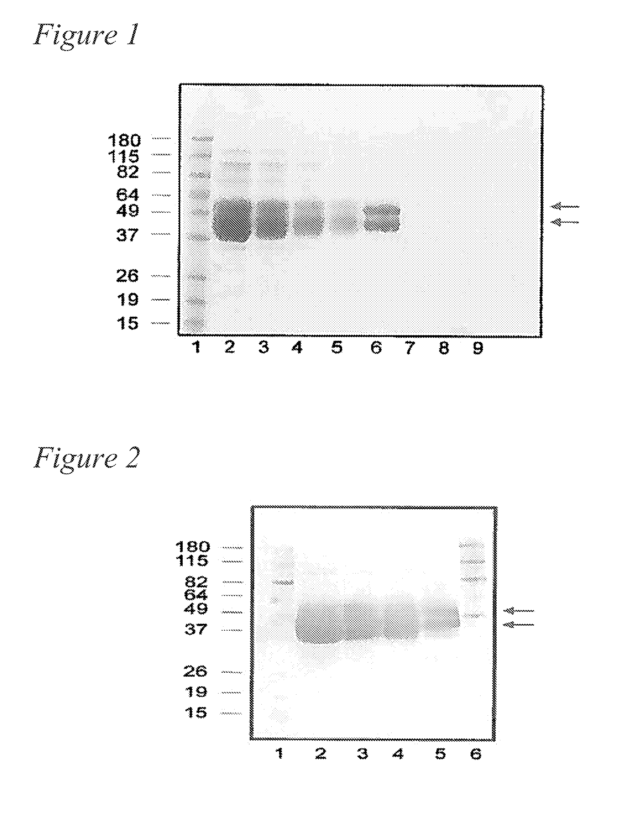 Formulations of human tissue kallikrein-1 for parenteral delivery and related methods