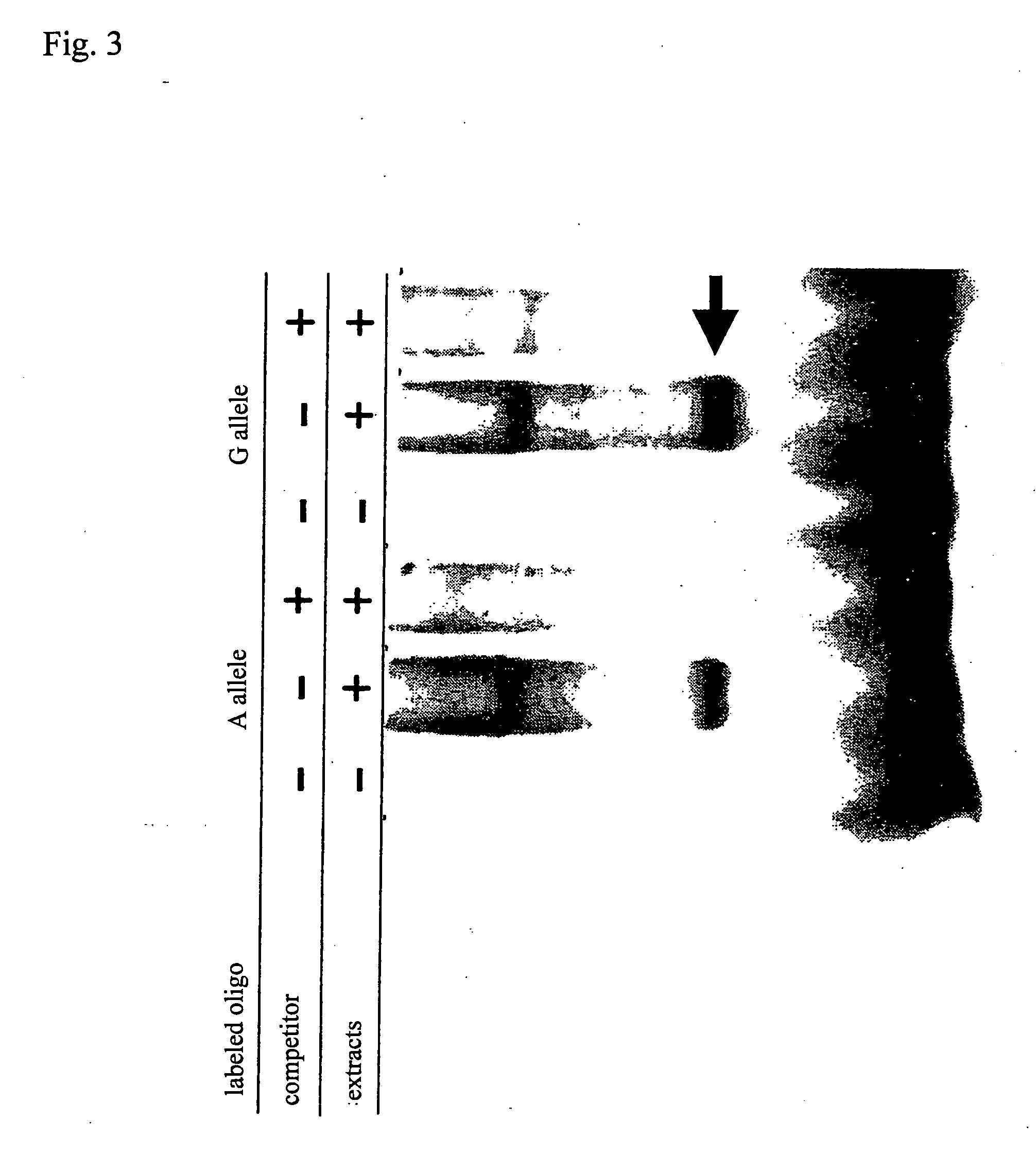 Method of judging inflammatory disease