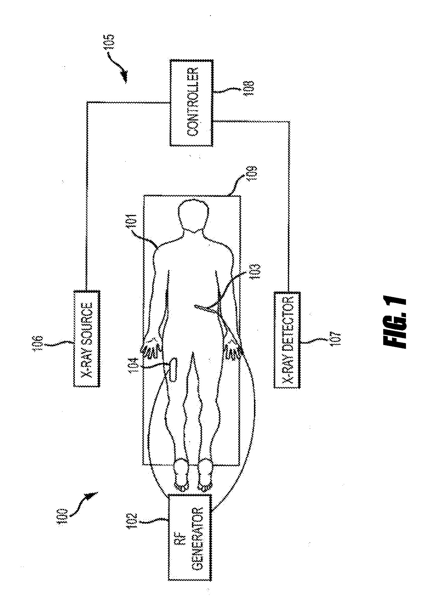 Systems and methods for tissue ablation