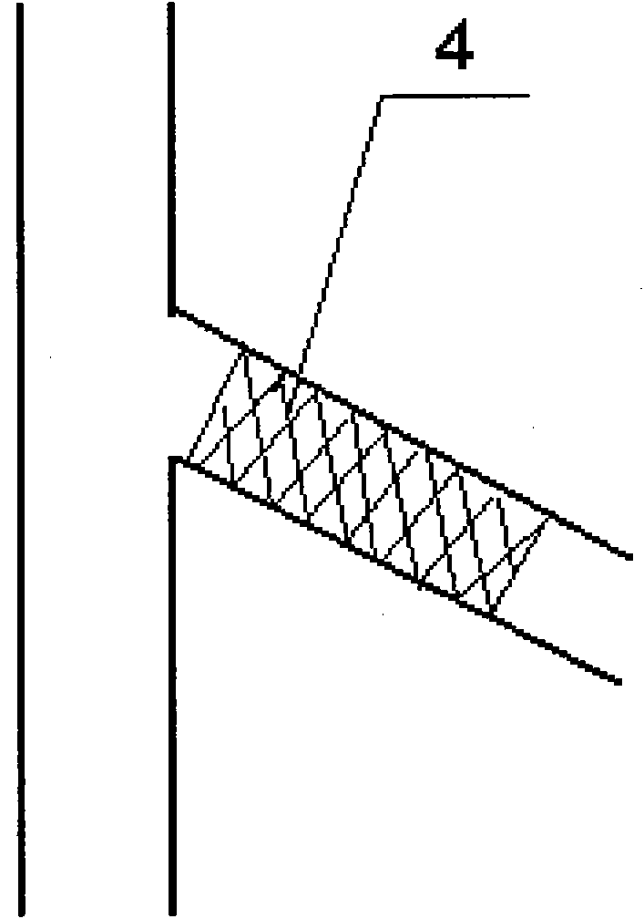 Interventional therapy method at vessel bifurcation