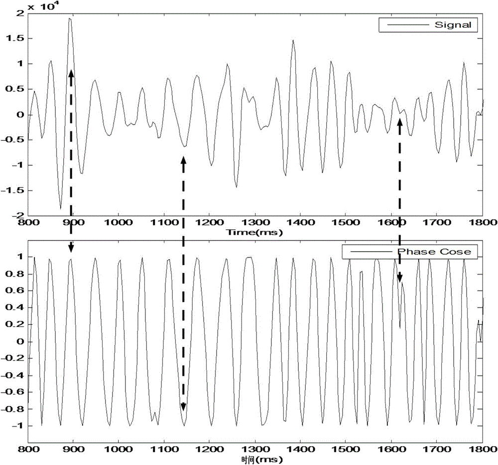 A Method of Adaptive Removal of Strong Earthquake Reflection