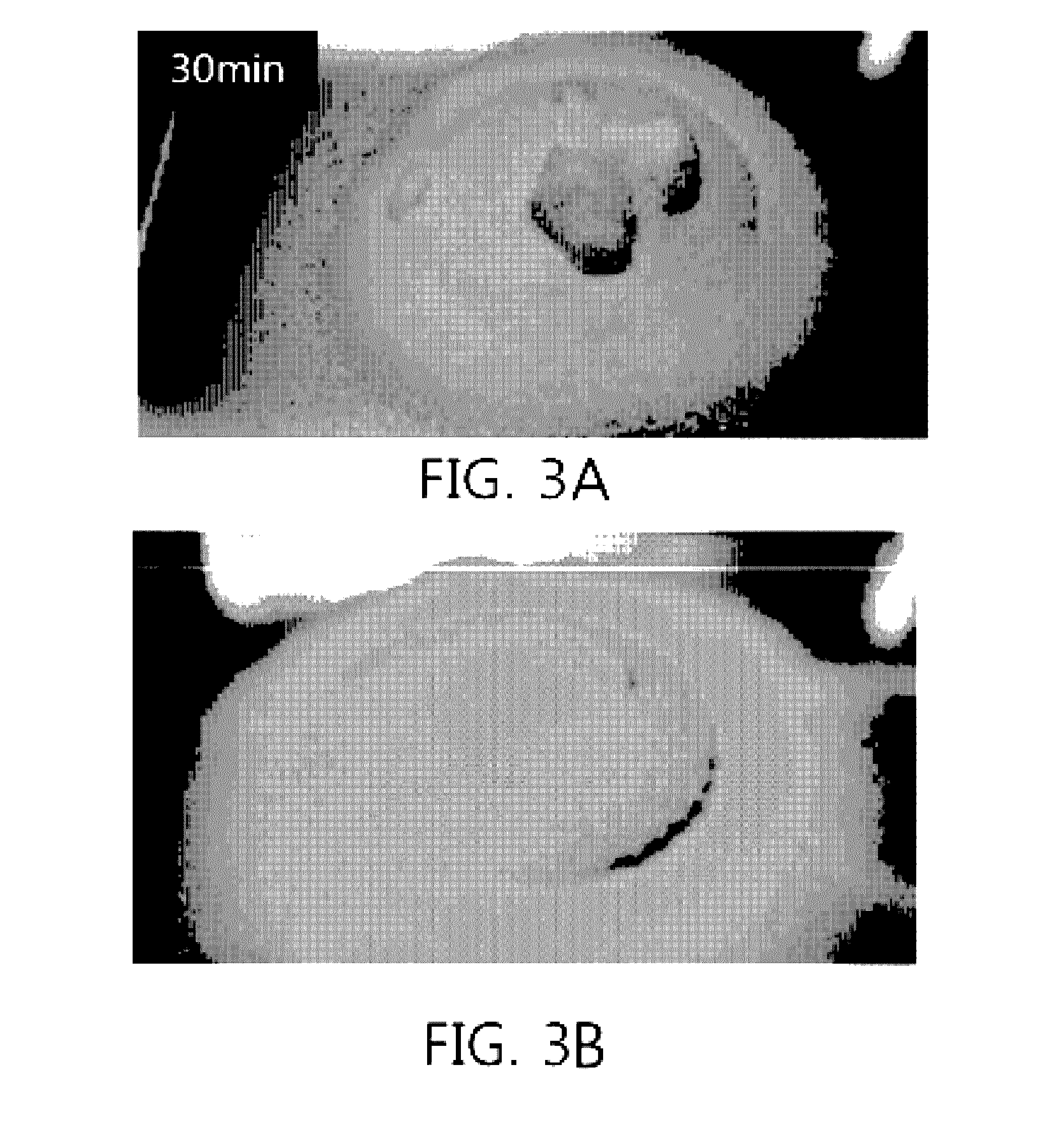 Super absorbent resin having improved solidification resistance, and method for preparing same