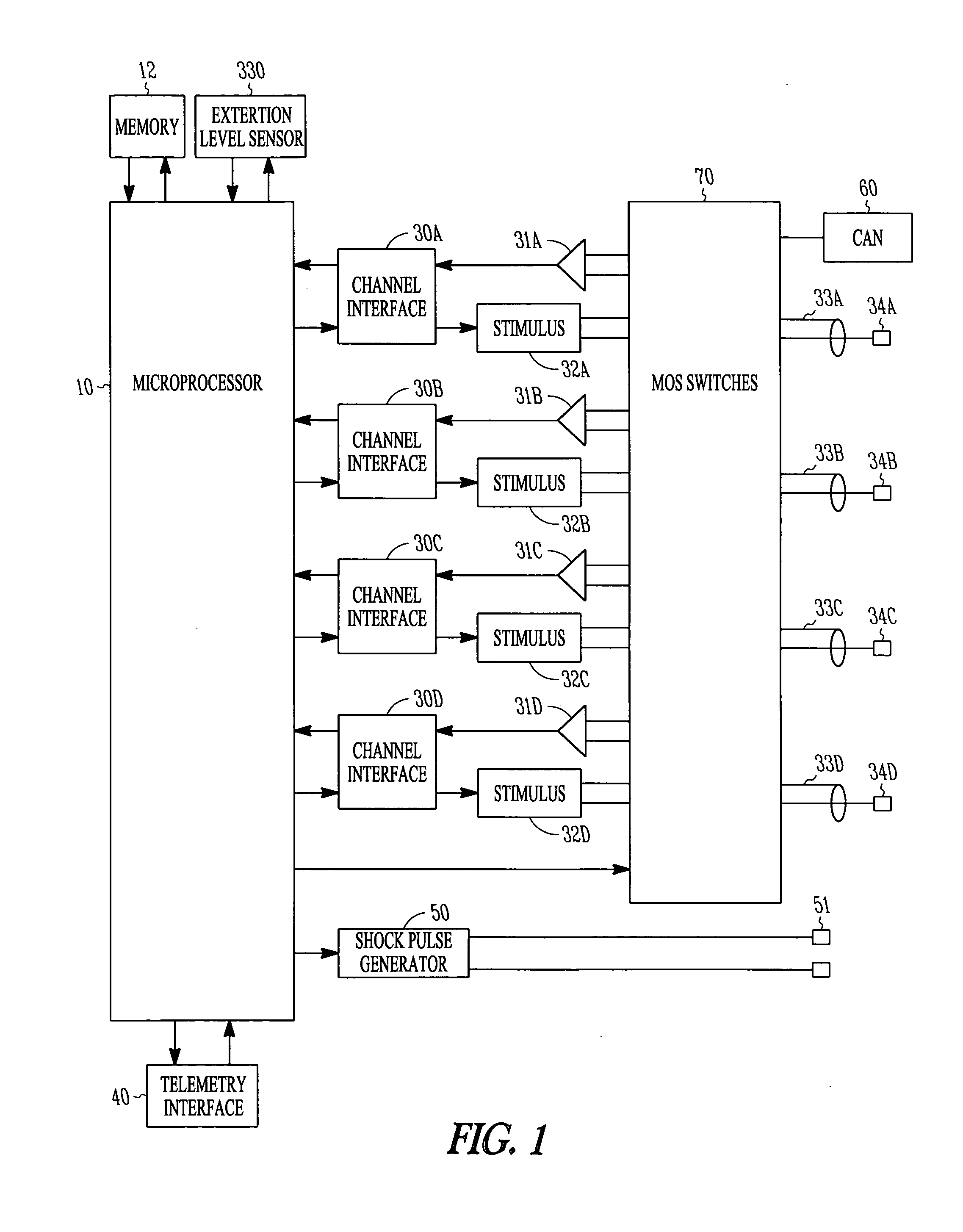 Pacing method and device for preserving native conduction system