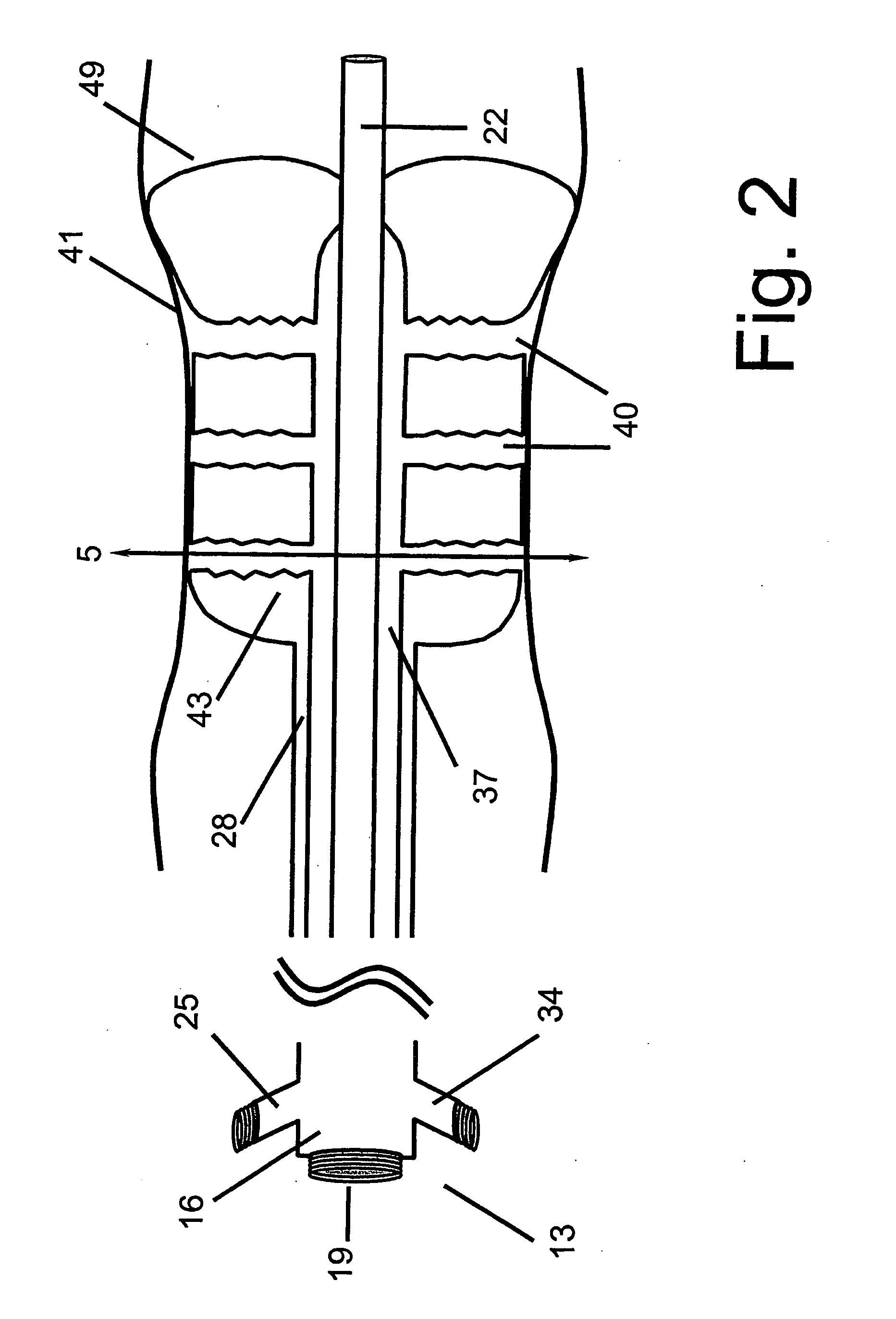 Angioplasty device with embolic recapture mechanism for treatment of occlusive vascular diseases