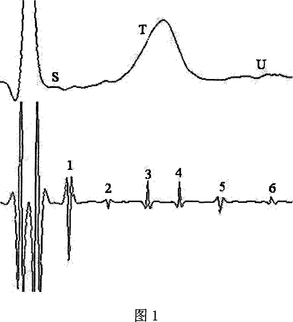 Body surface detection method and device for high frequency wave of repolarization of ventricle