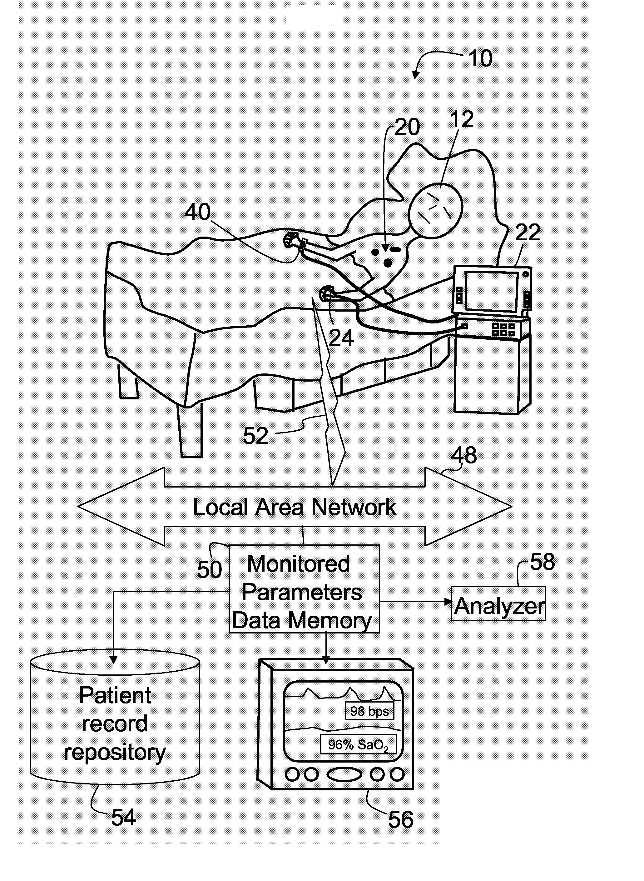 Apparatus To Measure The Instantaneous Patients' Acuity Value