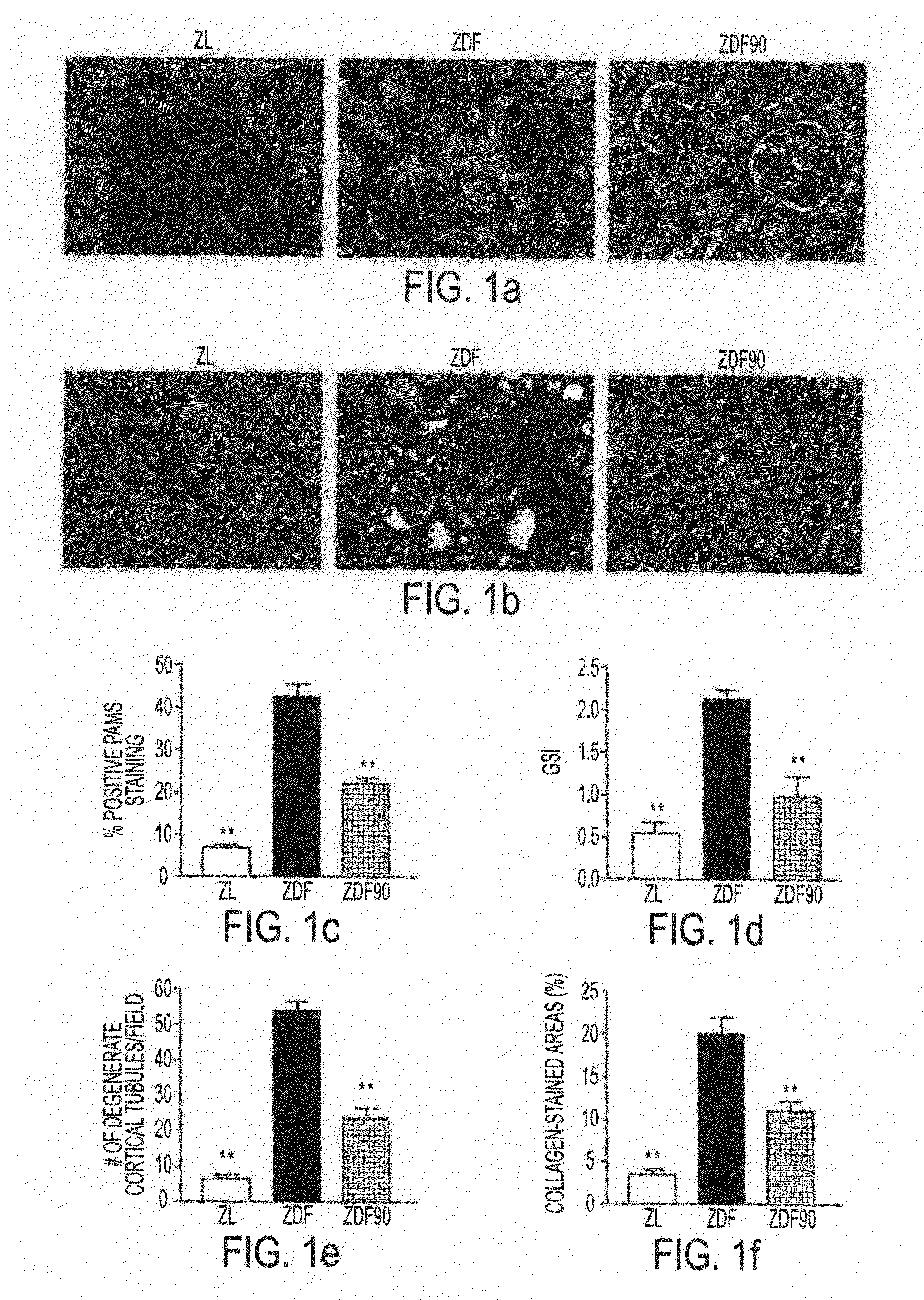 Use of lr-90 and lr-102 to overcome insulin resistance