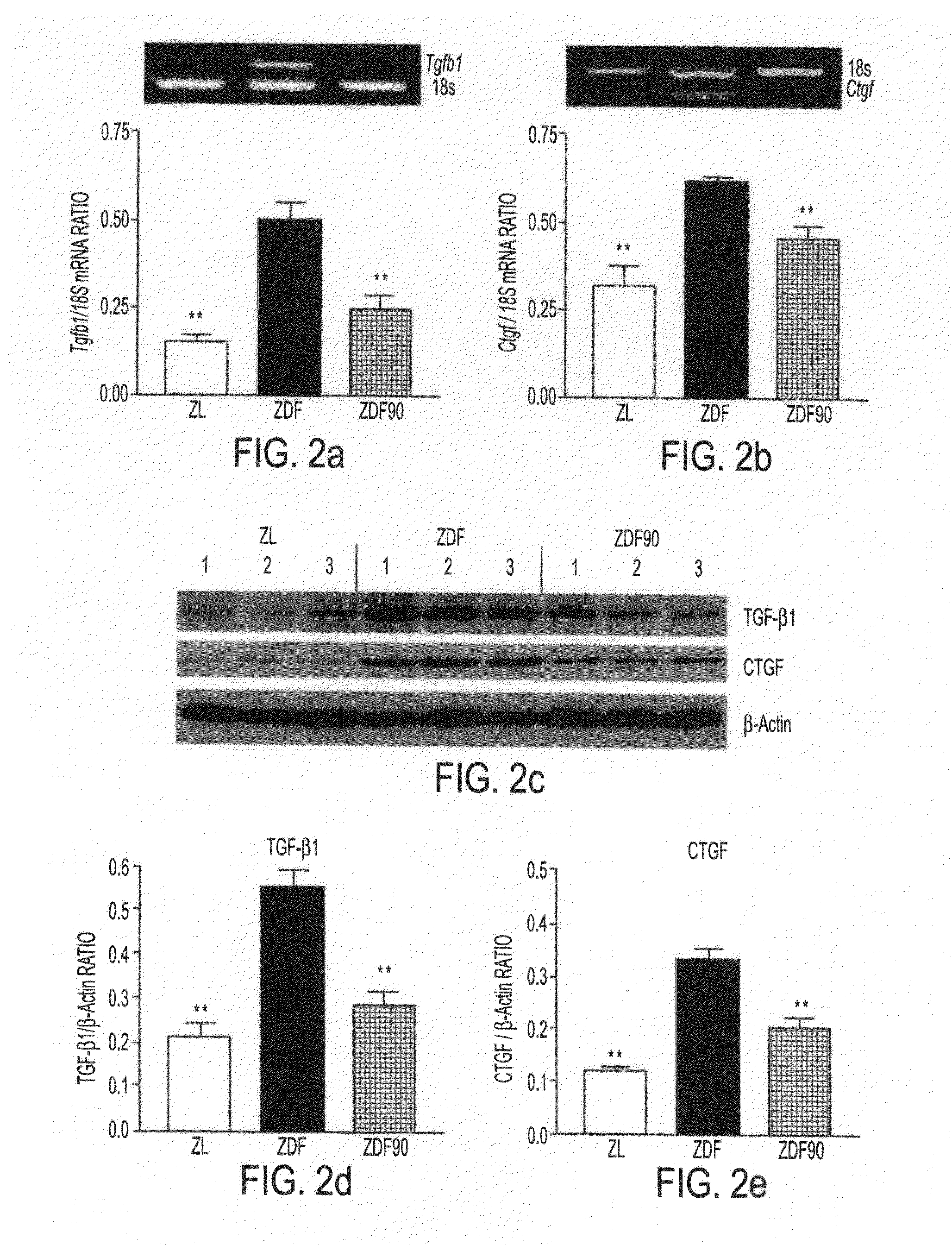 Use of lr-90 and lr-102 to overcome insulin resistance