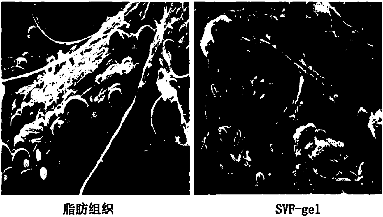 Composite cryopreservation solution and preparation method and application thereof