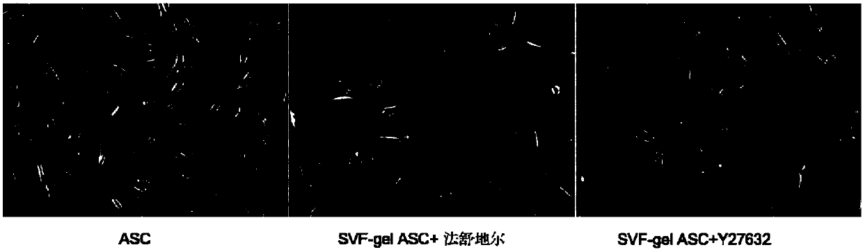 Composite cryopreservation solution and preparation method and application thereof