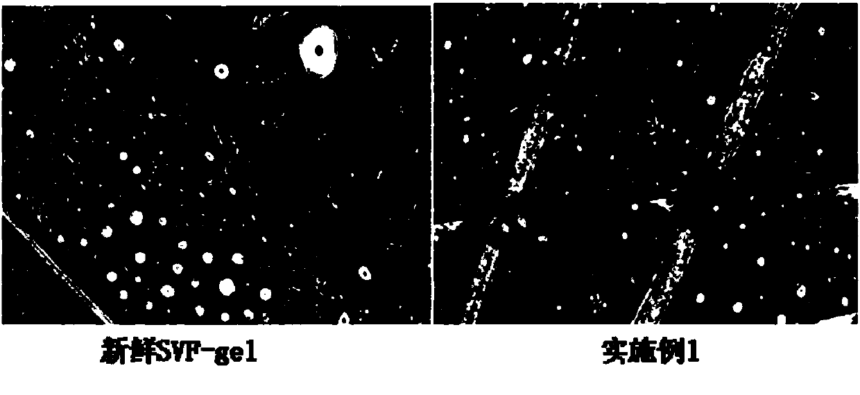 Composite cryopreservation solution and preparation method and application thereof