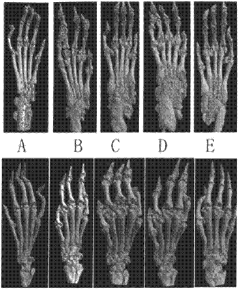 Compositions for alleviating, treating and preventing rheumatoid arthritis