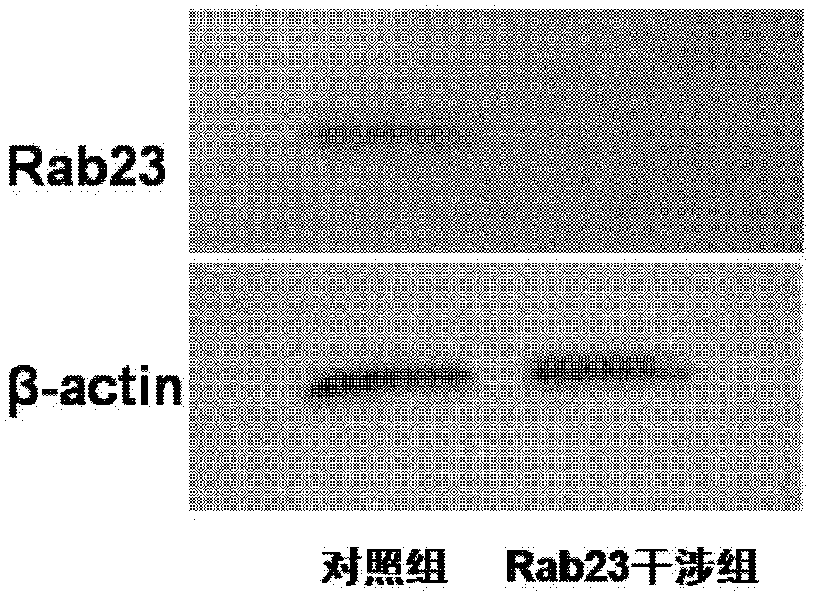 ShRNA of Rab23 and ientiviral vector and applications thereof