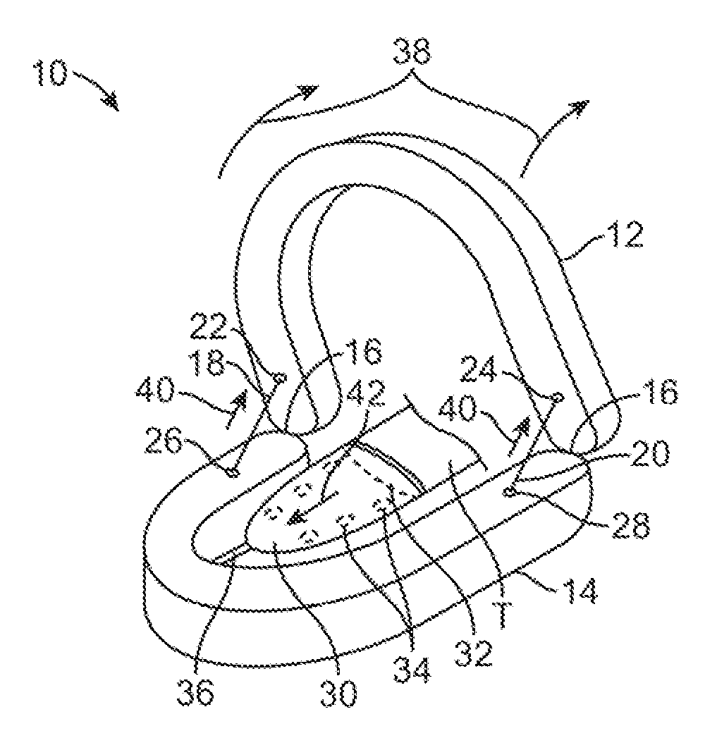 Automated tissue retention system