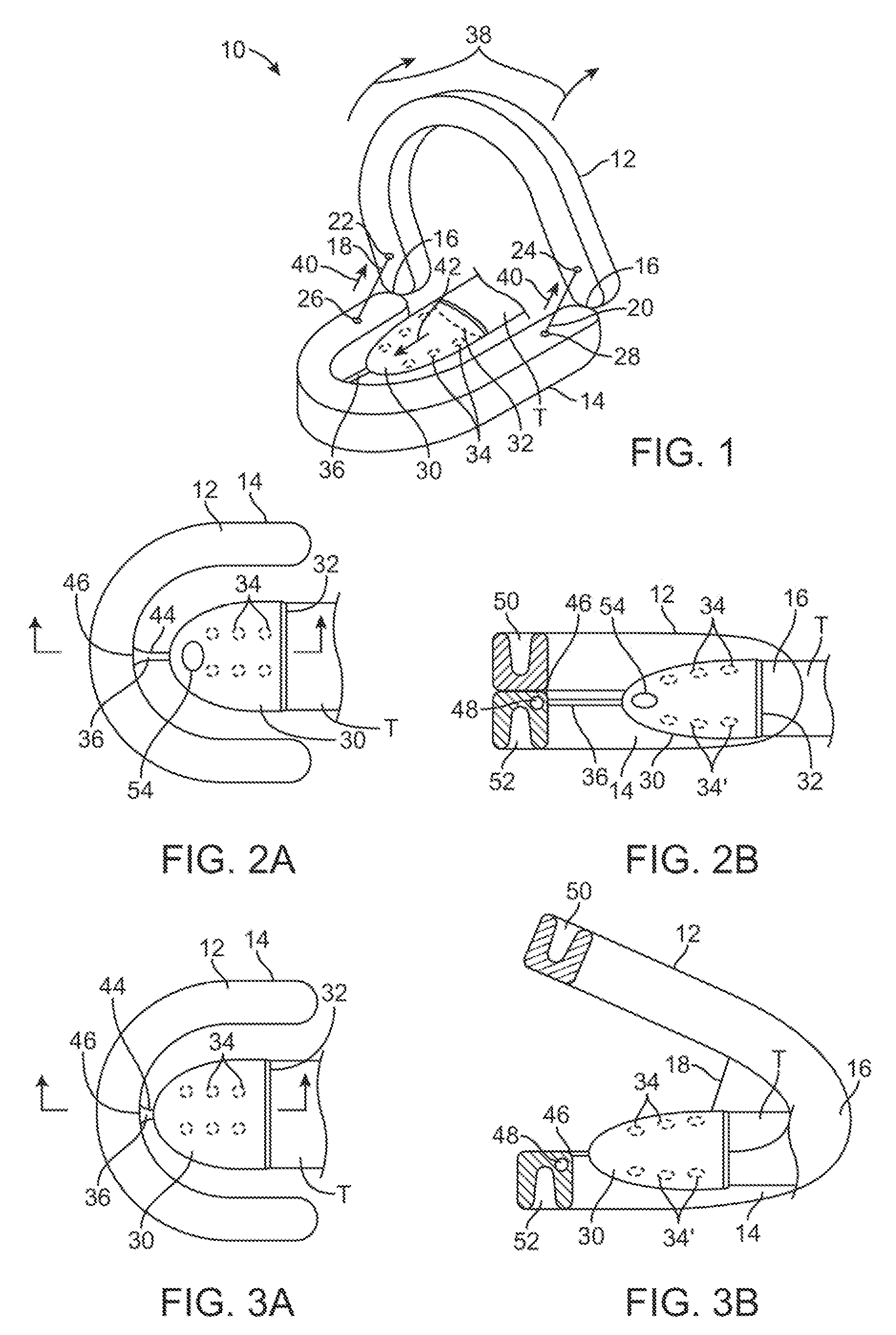 Automated tissue retention system