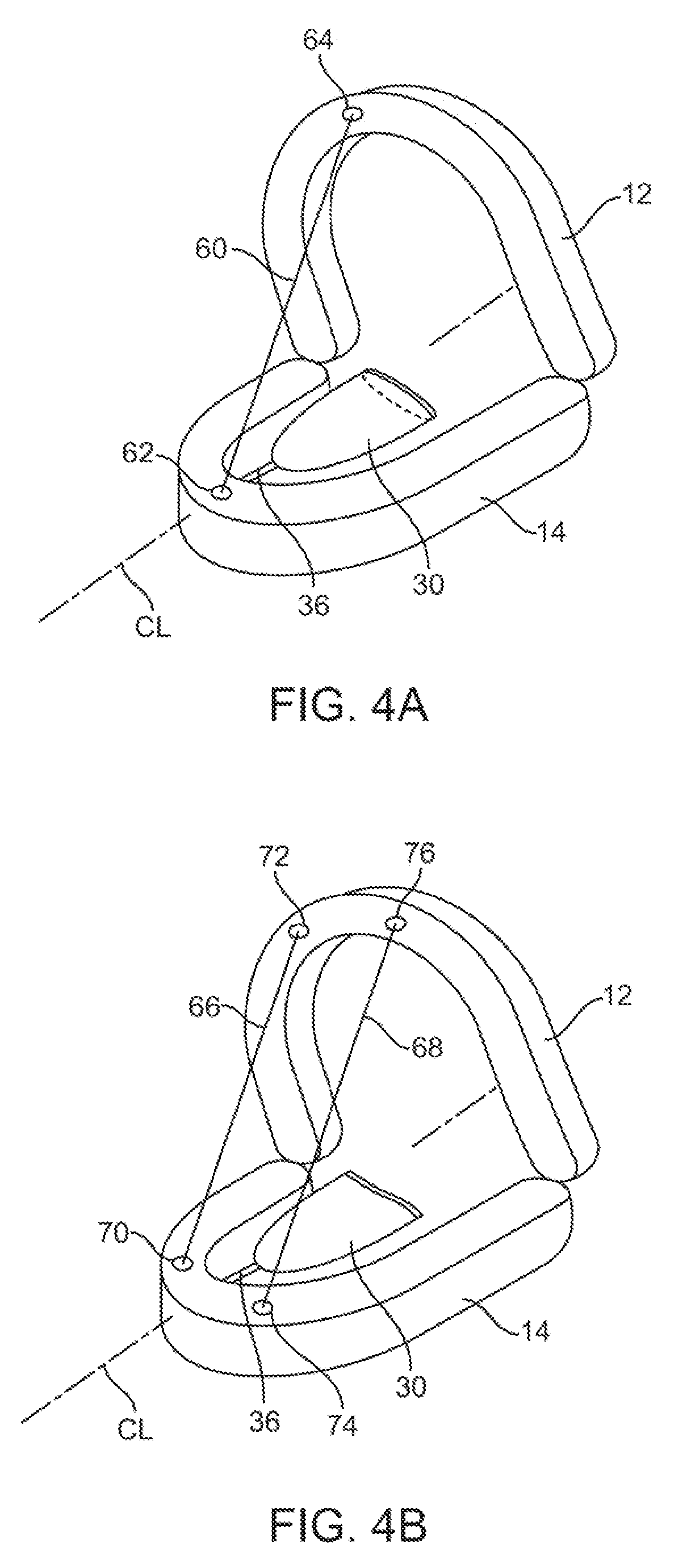 Automated tissue retention system