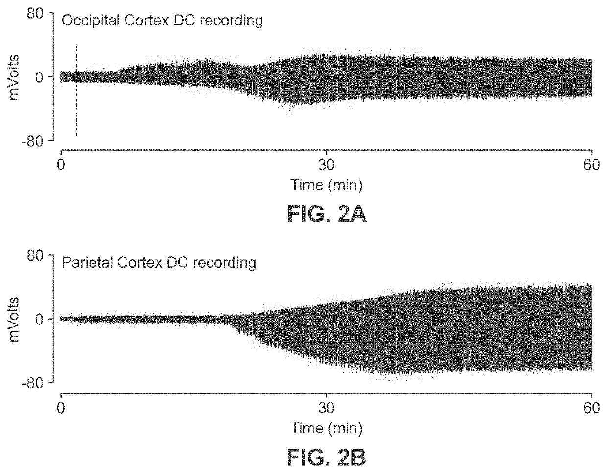 Methods for treating and for inhibiting progression of seizures
